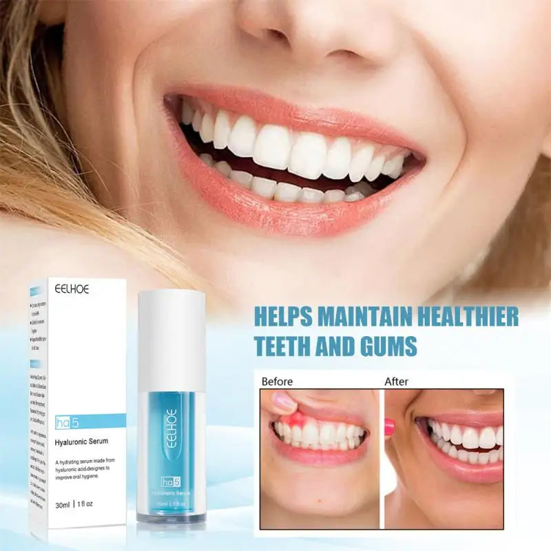 V34 Whitening Toothpaste 30ml Blue Purple Corrector Teeth Effective Whitening Oral Cleaning Remove Cigarette Stains Reduce Yellowing