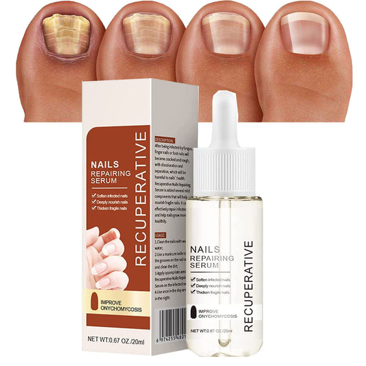 7 Days Nail Growth and Strengthening Serum, Nail Strengthener, Nail Serum Repair Essence, Nail Growth Serum, Stronger Nails in 1 Week Nail Strengthening Treatment (1PCS)